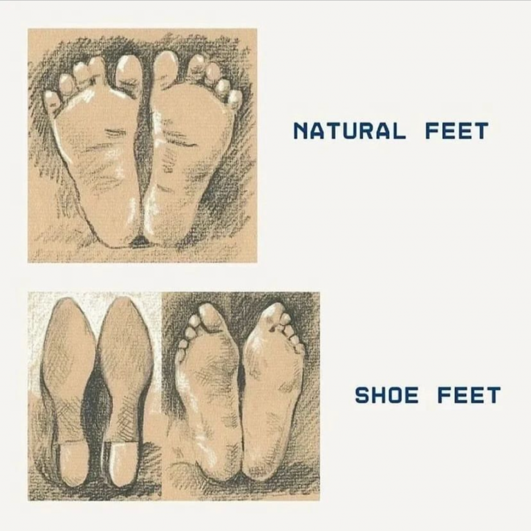 Fix Plantar Fasciitis at Home